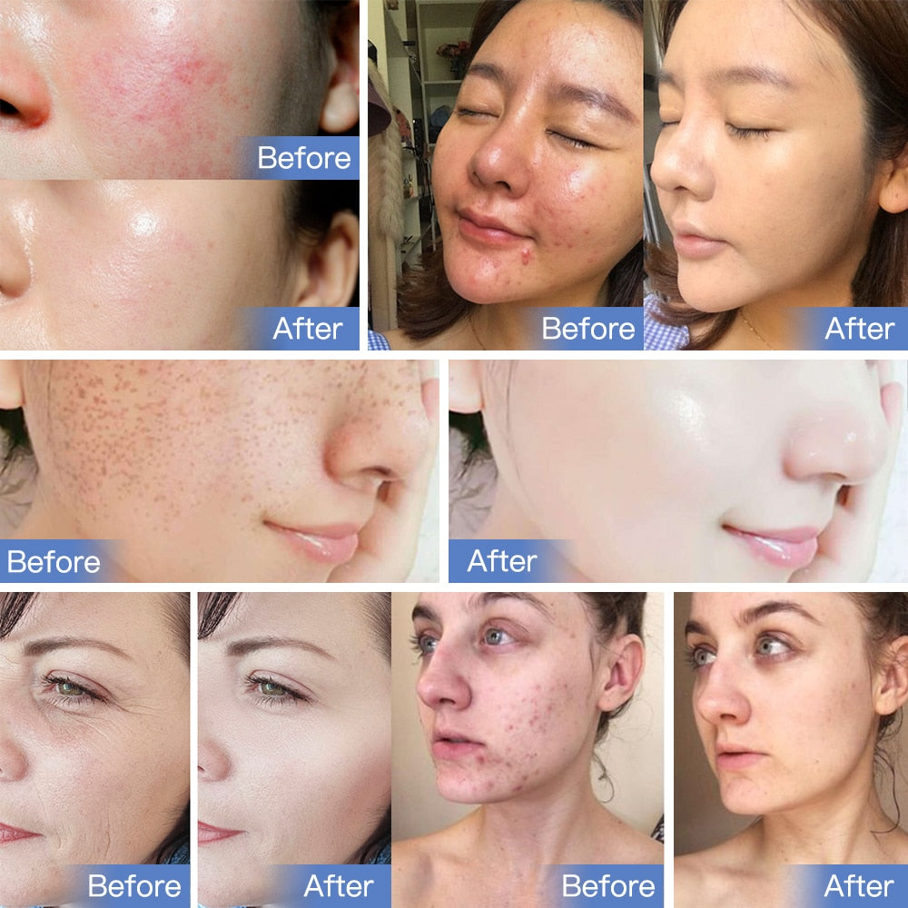 7 Colors Led Mask PDT LED Light Therapy Skin Care Tools Beauty Health Facial Mask Spa with Led Light Acne Remove Anti Wrinkle